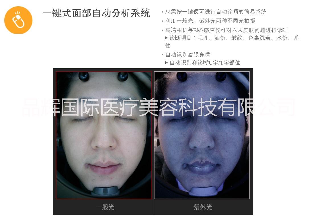 上海（品辉国际）皮肤测试仪批发